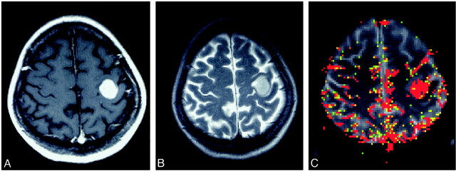 fig 2.