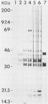 1918