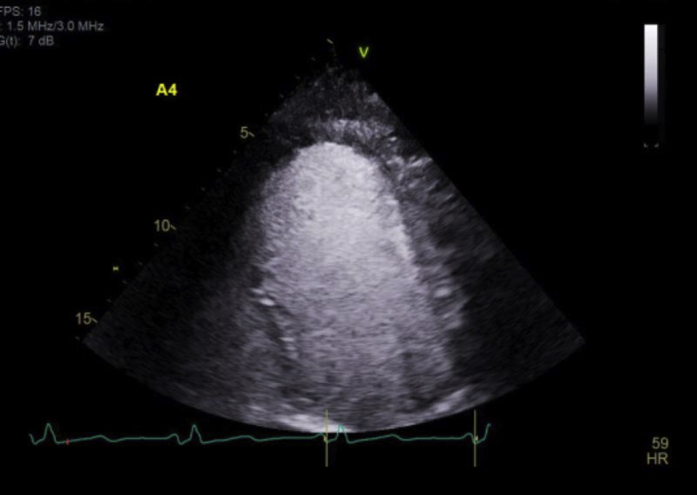 Figure 4