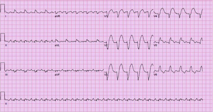 Figure 2