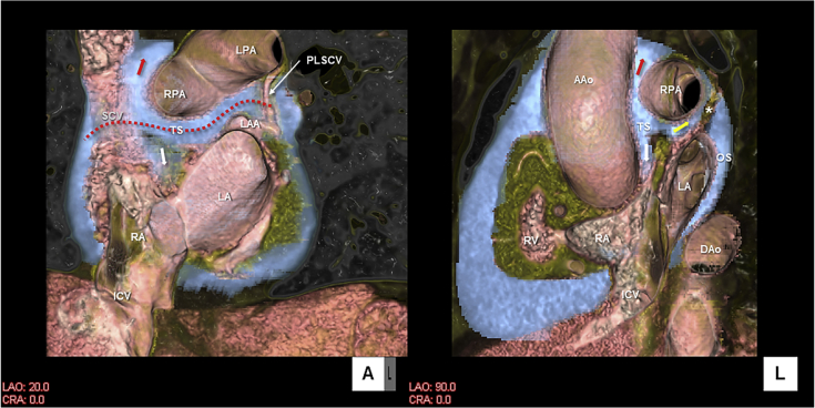 Figure 3