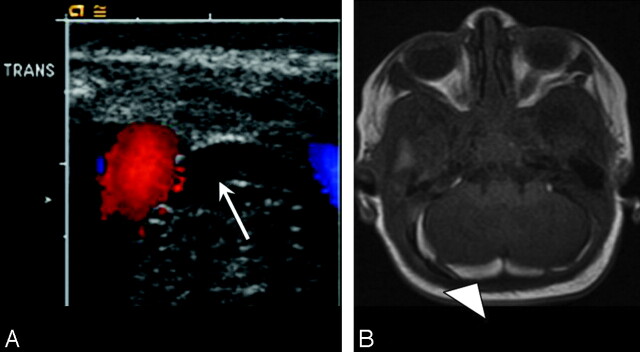 Fig 3.