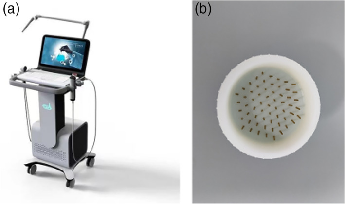 FIGURE 12