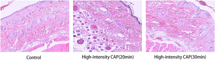 FIGURE 3