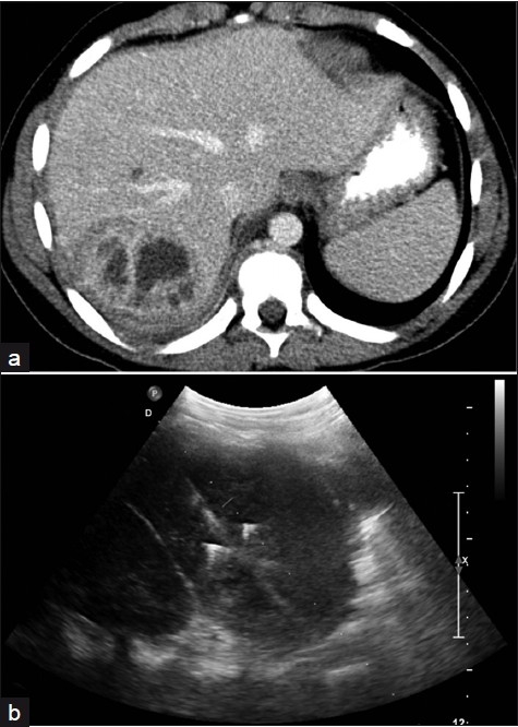 Figure 16