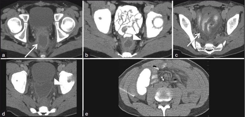 Figure 14