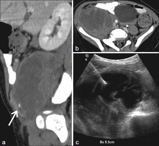 Figure 15