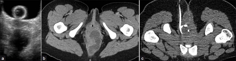 Figure 17