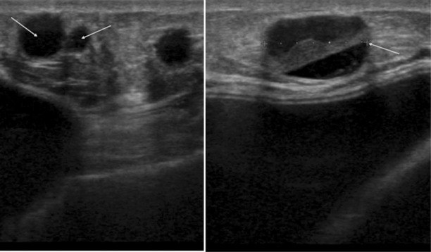 Fig.2