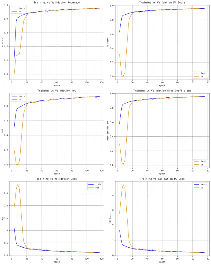 Six line graphs compare training and validation metrics over 120 epochs. Top left: accuracy shows convergence. Top right: F1 score follows a similar pattern. Middle left: IoU displays improvement. Middle right: Dice coefficient increases steadily. Bottom left: loss decreases for both. Bottom right: DC loss also declines. Training data is in blue, validation in orange.