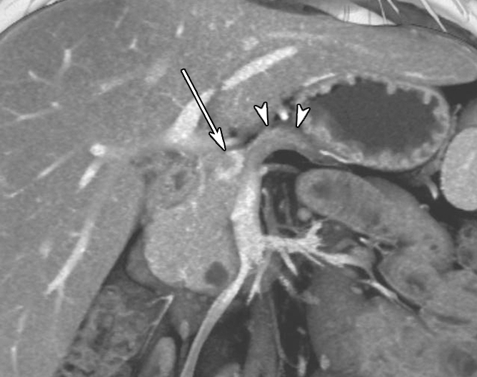 Figure 1b: