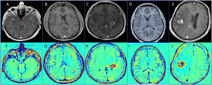 Fig. 4