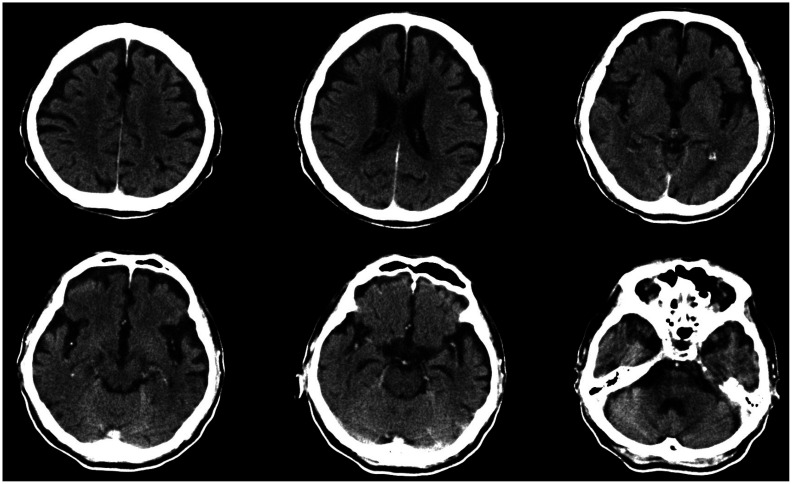 Fig. 1