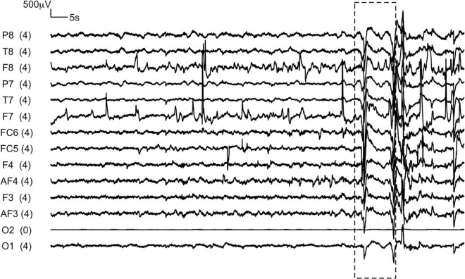 FIGURE 2