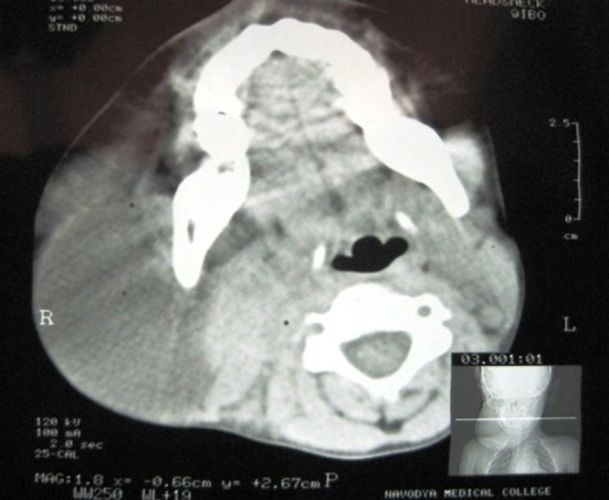 Fig. 2