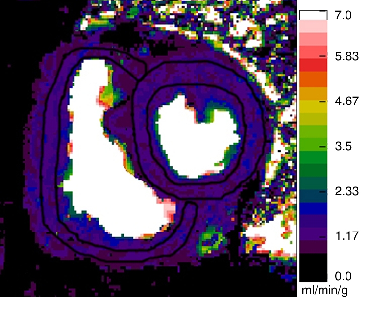 Figure 1c: