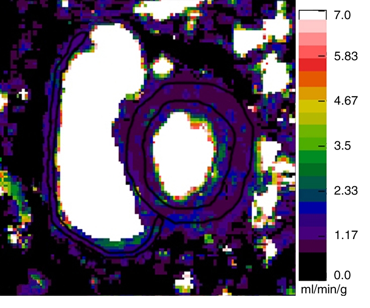 Figure 1a: