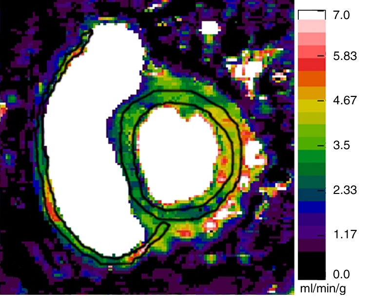 Figure 1b: