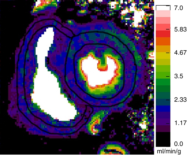 Figure 1d: