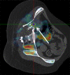 Figure 3b:
