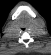 Figure 2b:
