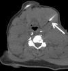 Figure 2f: