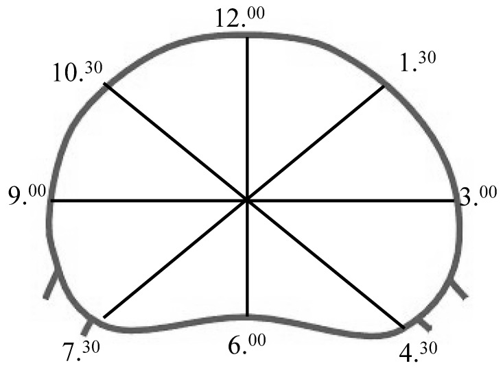 Fig. 2