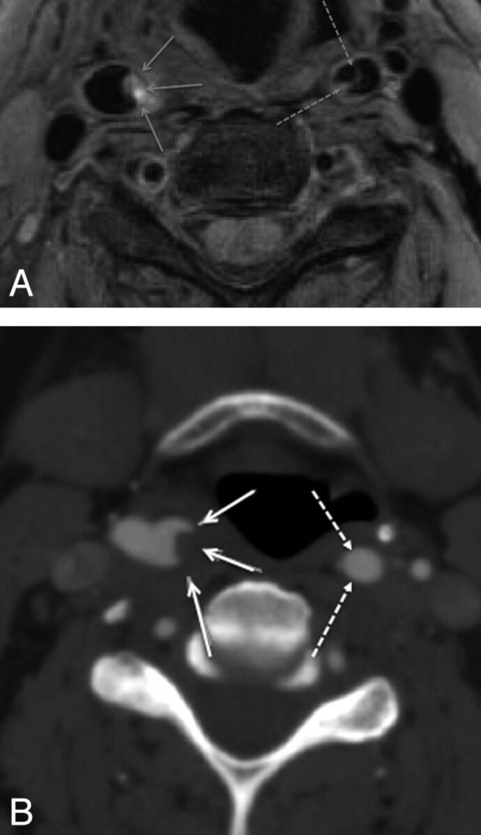 Fig 1.