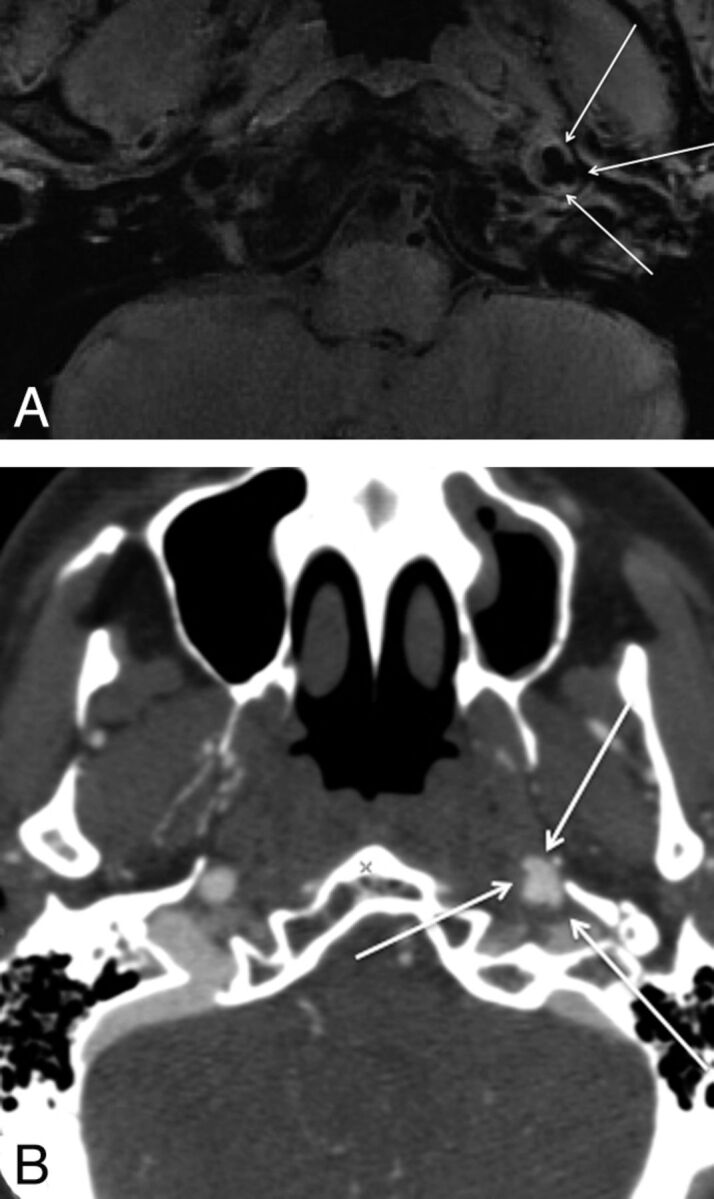 Fig 5.