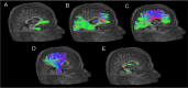 Fig. 4