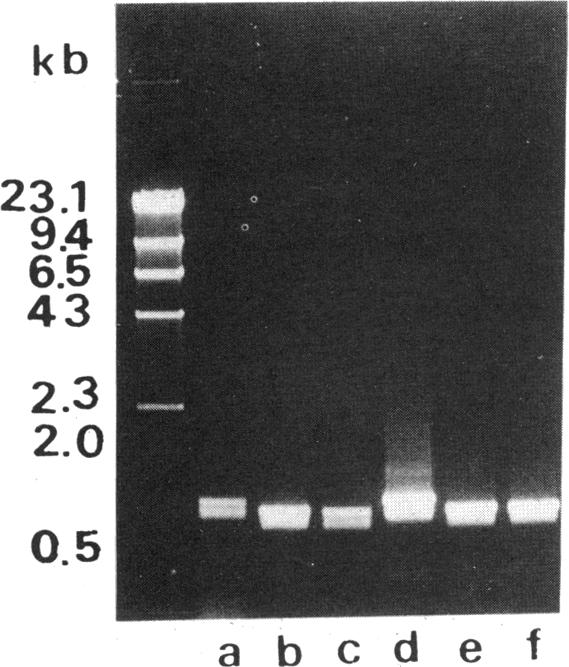 graphic file with name jbacter00049-0196-a.jpg