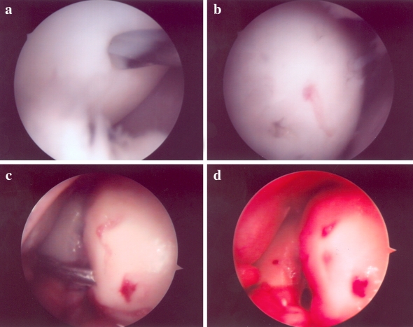 Fig. 2