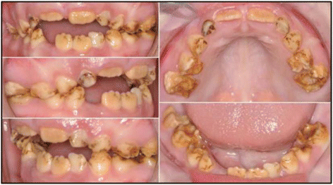 Fig. 10