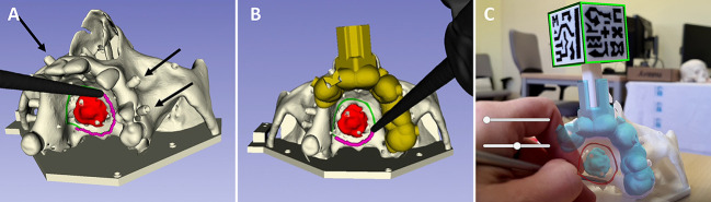 Figure 2