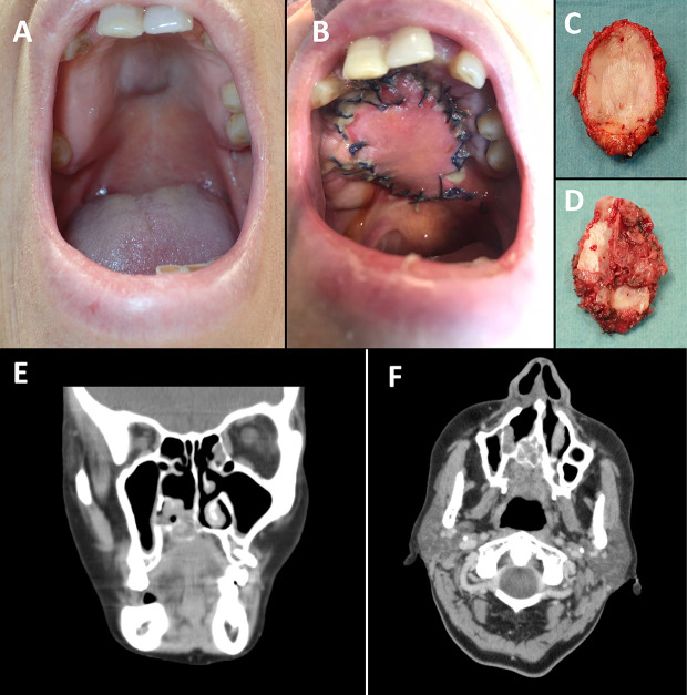 Figure 1