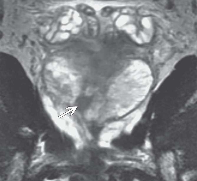 Figure 4b: