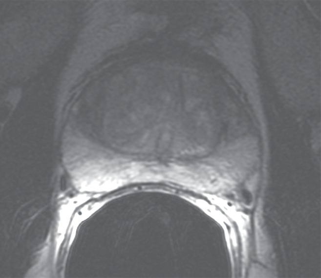 Figure 3a: