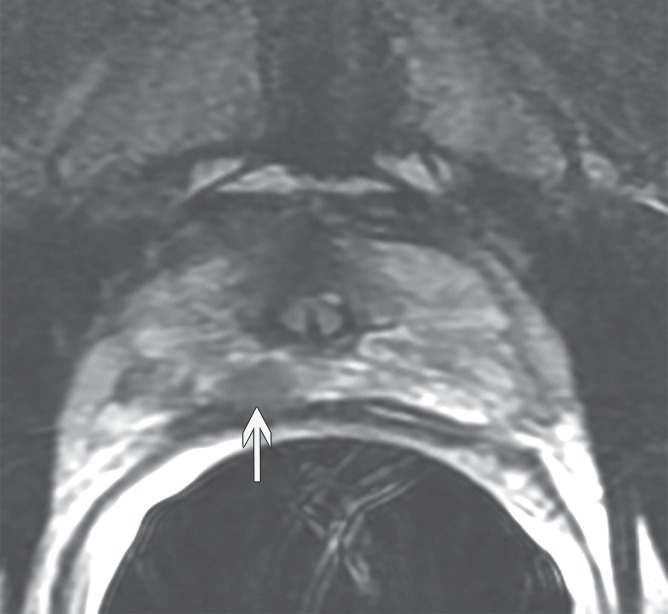 Figure 4a: