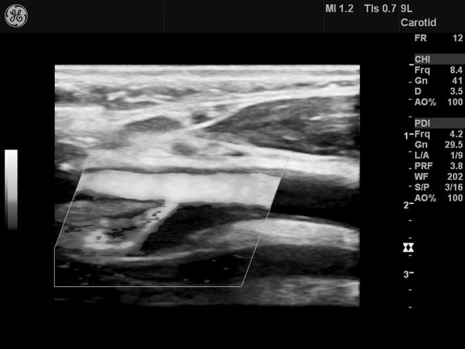 Supplementary figure 3