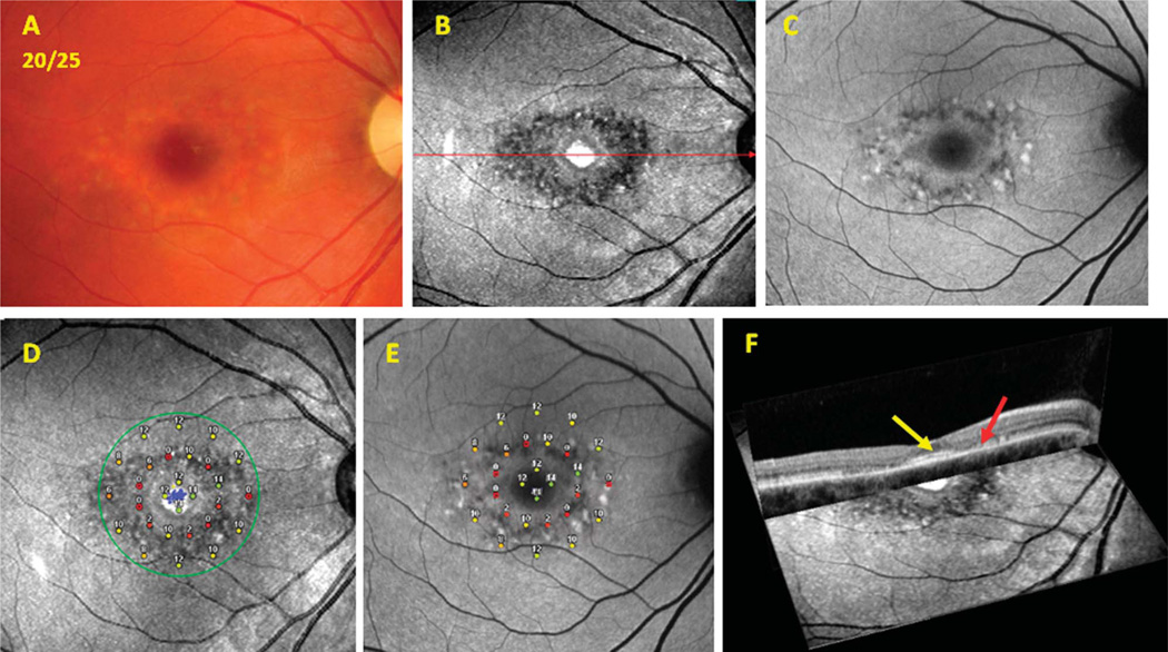 Fig. 2