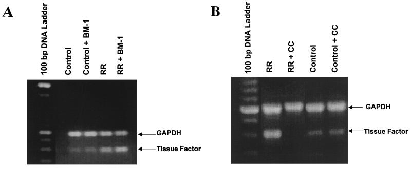 FIG. 5