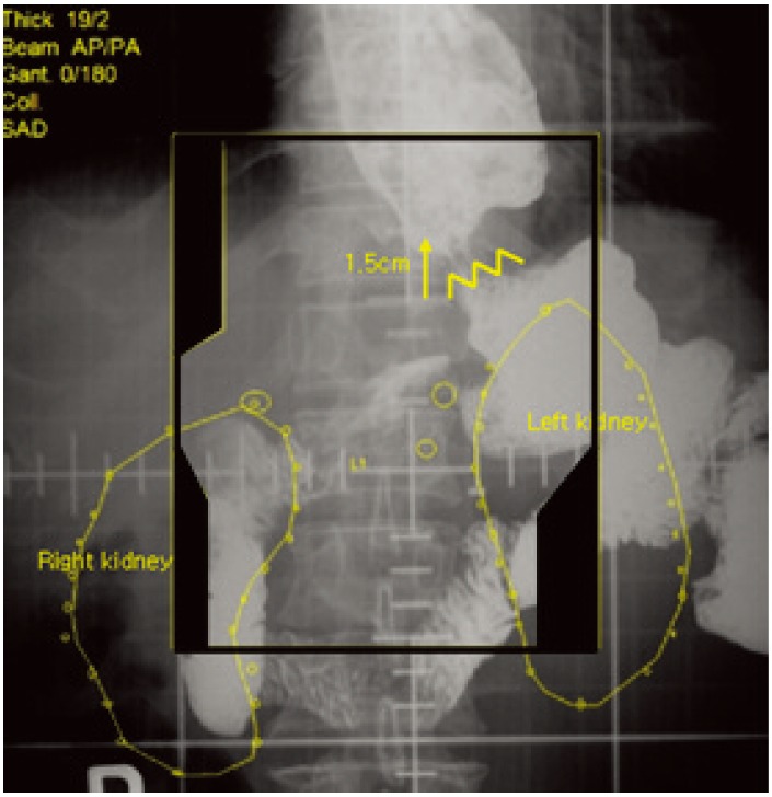 Fig. 2.