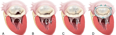 Figure 5