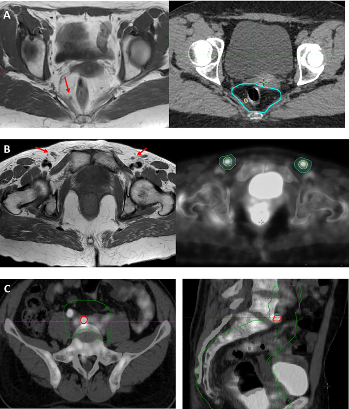 Figure 2