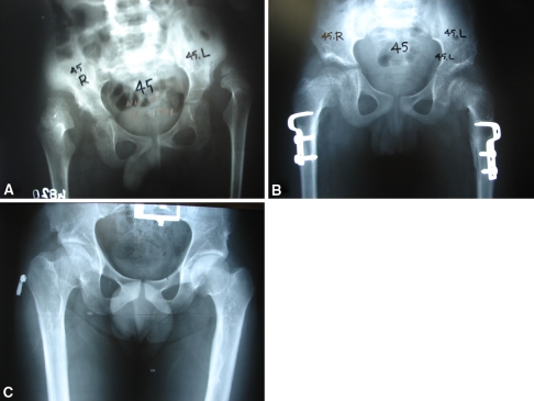 Fig. 3A–C