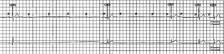 Figure 2