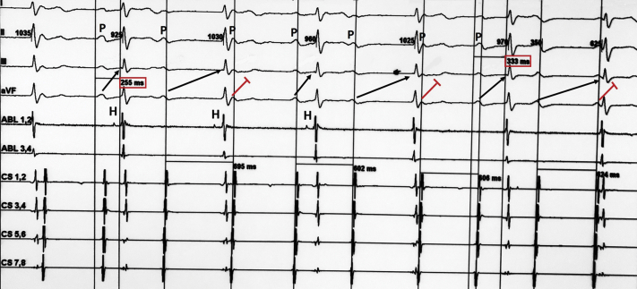 Figure 4