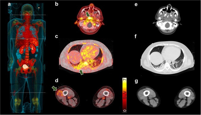 graphic file with name 259_2022_5932_Figa_HTML.jpg