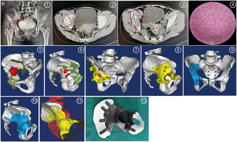 Fig. 3