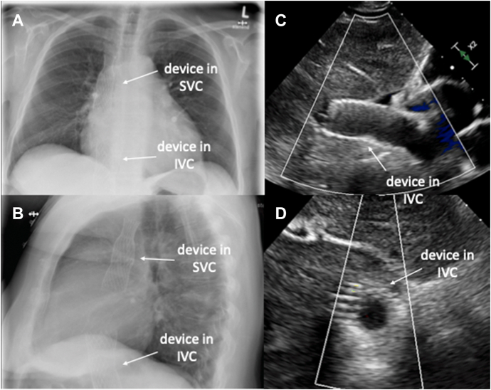 Figure 3